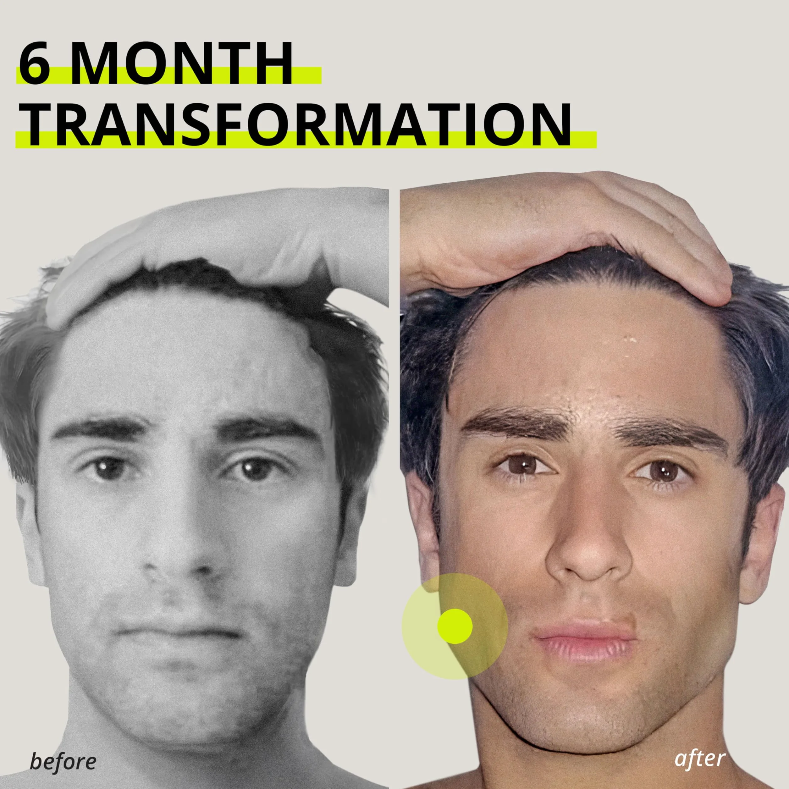 Jawliner® Chewing-gum à mâcher pour sculpter la mâchoire, renforcer les muscles, entraînement facial, mewing - Menthe - 40 pièces